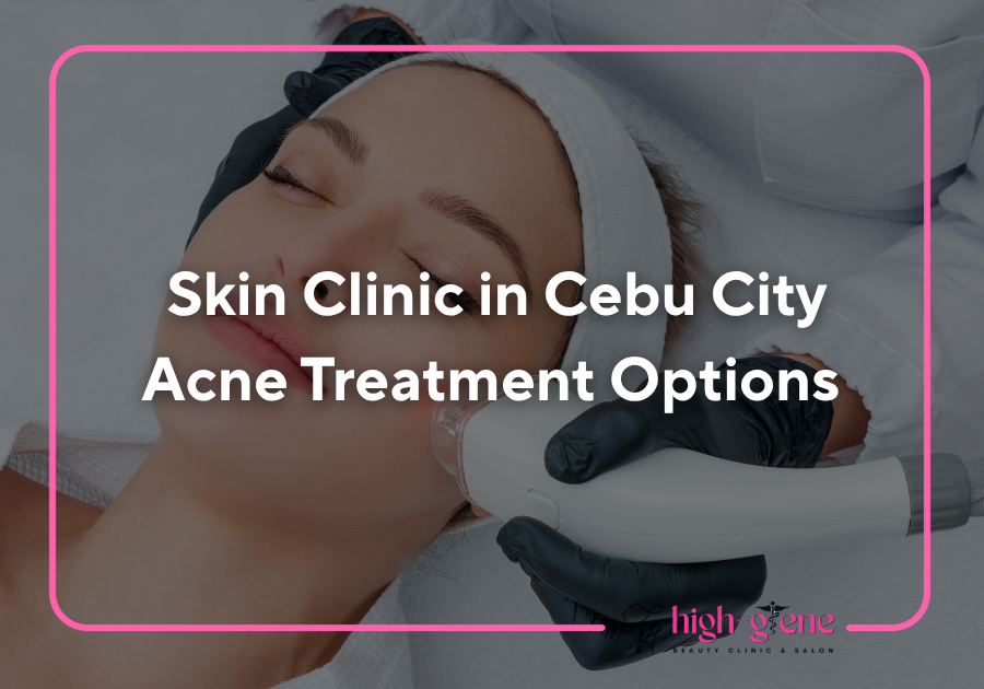 Skin Clinic in Cebu City | Acne Treatment Options